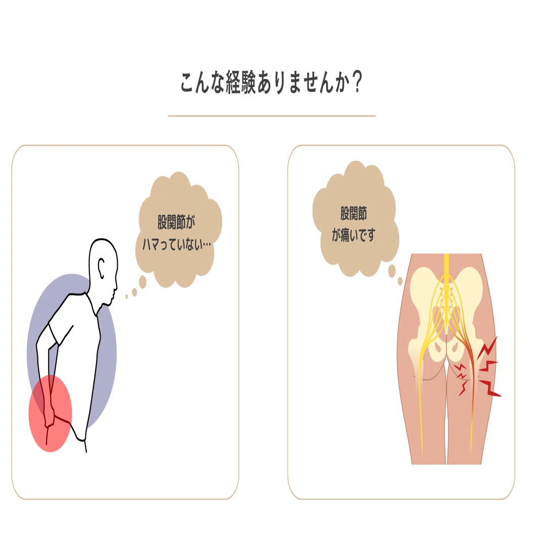 股関節のつまり』の原因はコレ！解剖からわかる2つのアプローチ方法