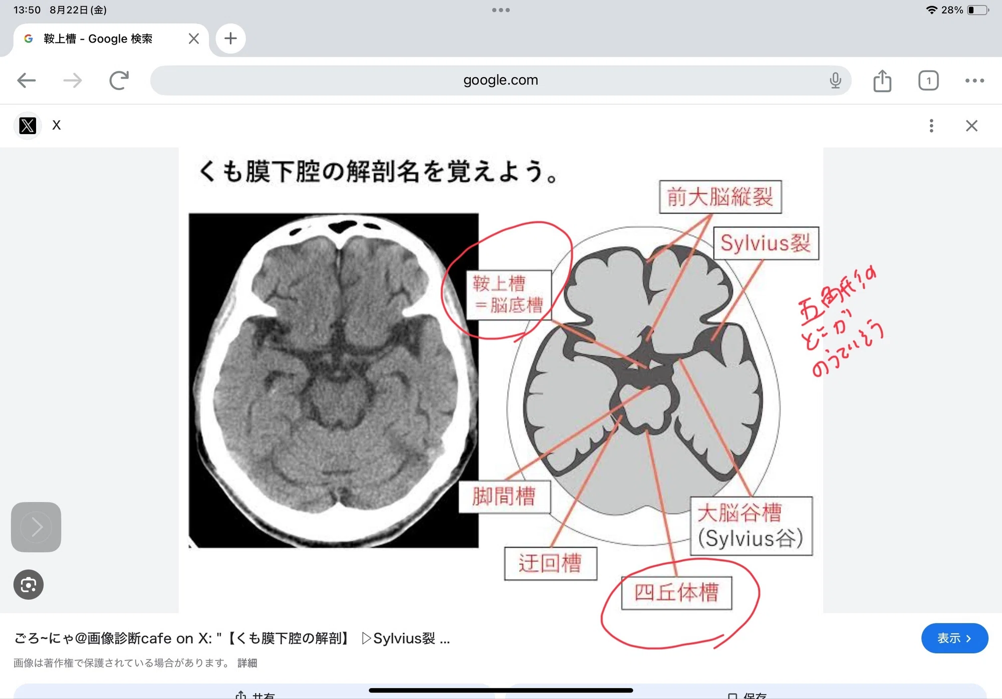当時のメディア報道・掲載写真