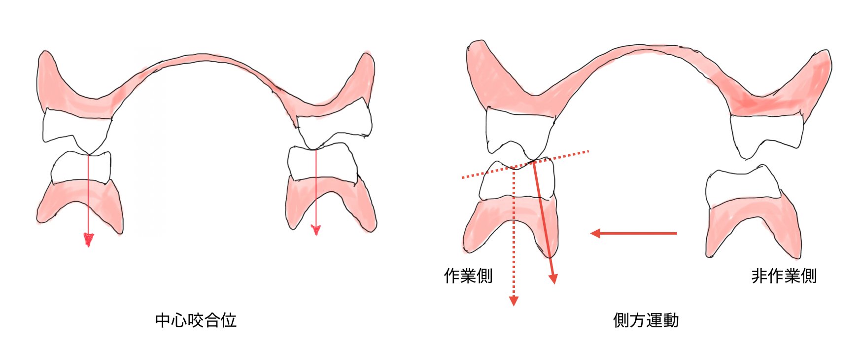 咬合理論（リンガライズドオクルージョン）について！｜Hiro