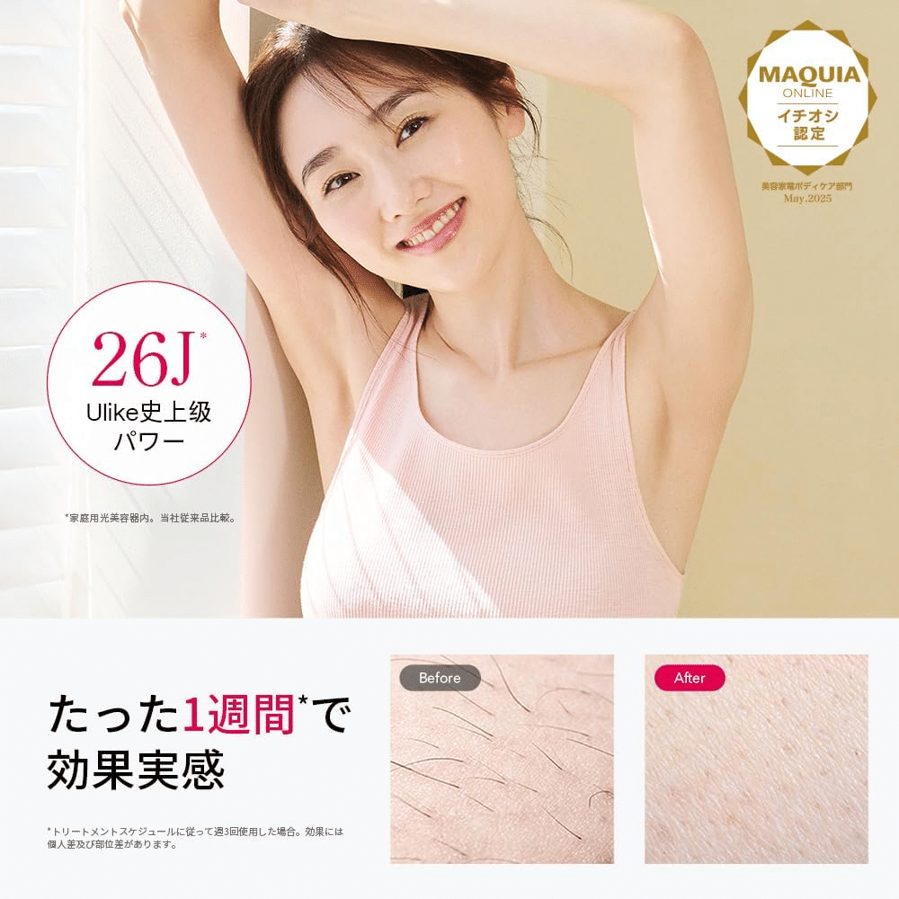 Ulike Air10 光美容器 ホワイトゴールド｜GetGadgetGot