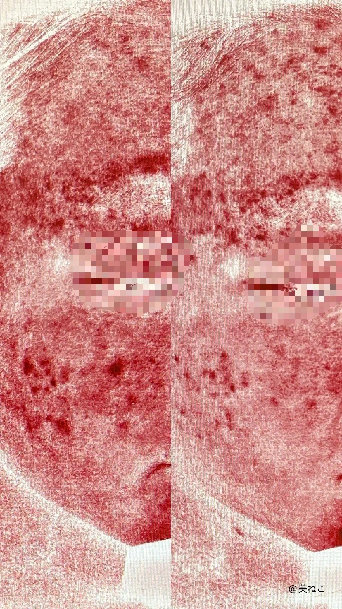 使用レポ】肌常在菌に着目次世代スキンケアBiojuveで肌育中!!｜美ねこ