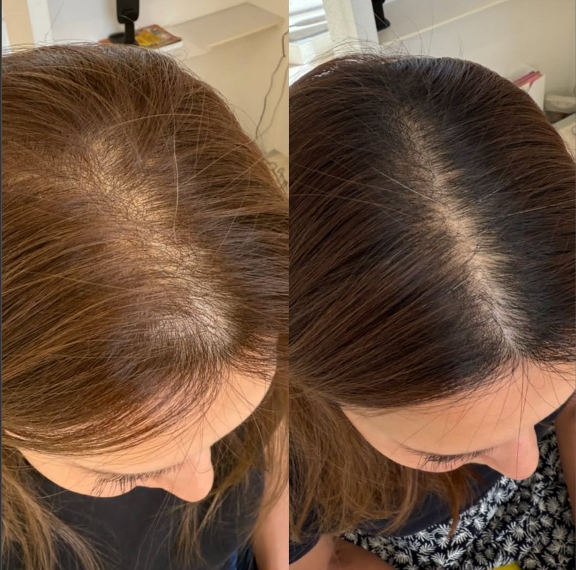 遂に日本上陸！プロセルセラピーズとは？｜プロセルセラピーズ熊本｜毛