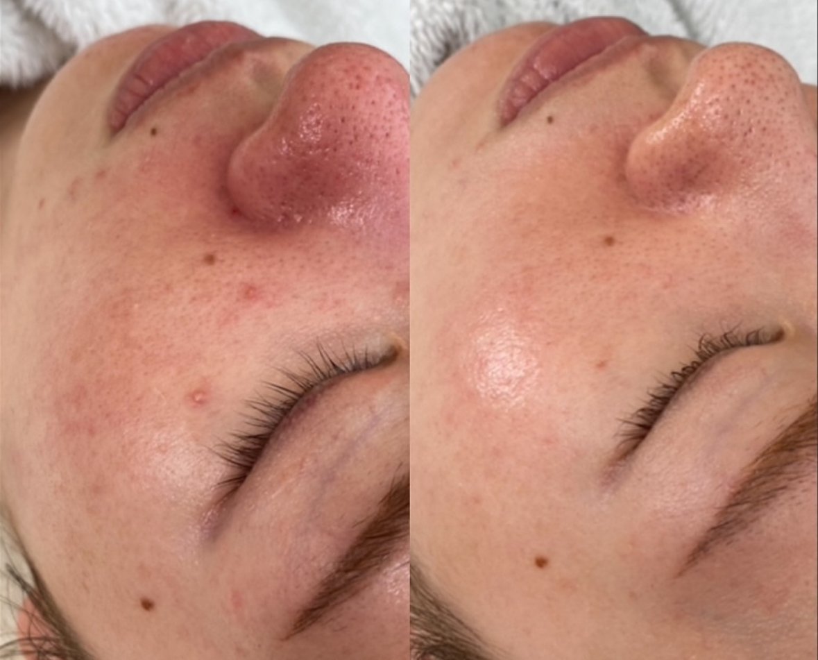 遂に日本上陸！プロセルセラピーズとは？｜プロセルセラピーズ熊本｜毛