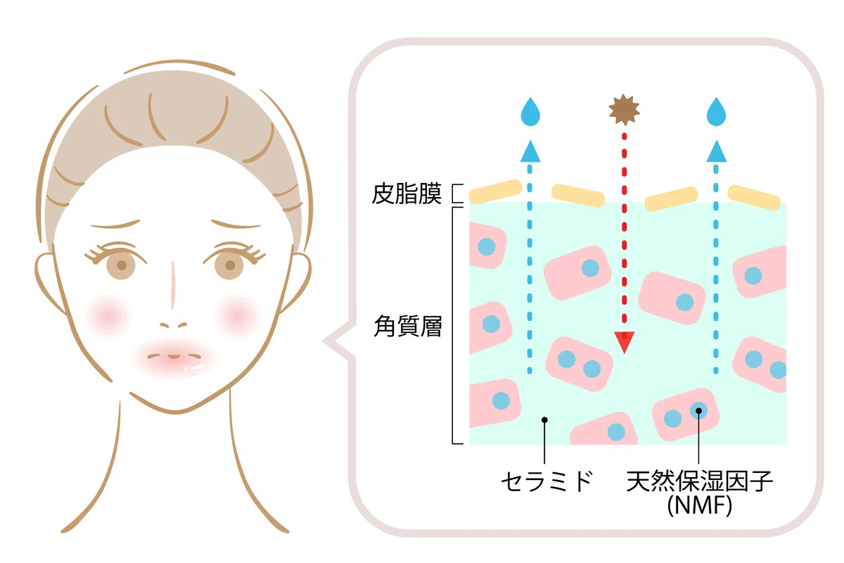 「夜勤で肌が荒れやすいのはなぜ？」｜宮崎県漢方薬局ほどよい堂