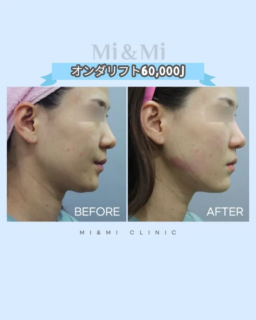 公式】韓国ラポエルクリニック on X: 