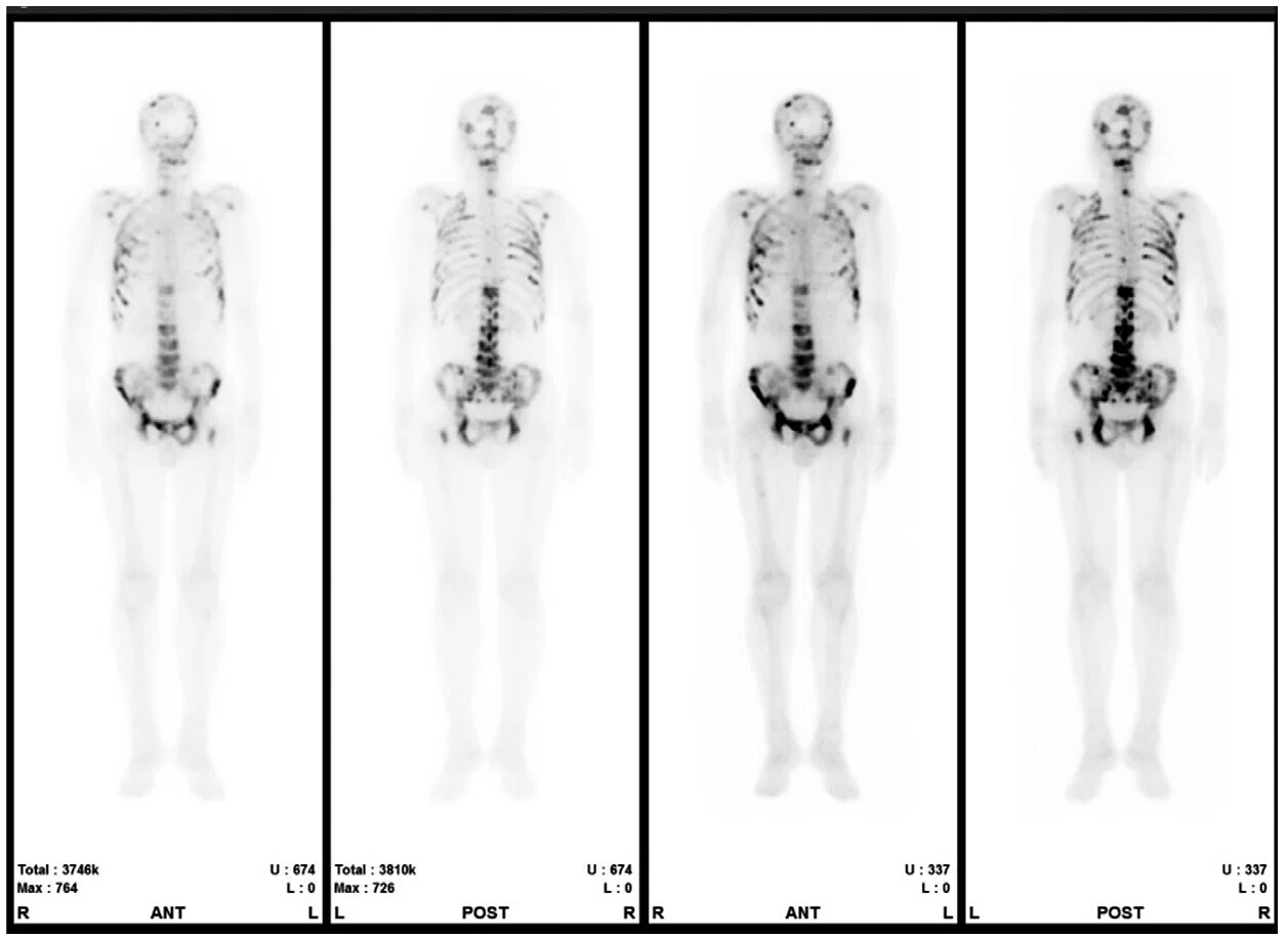 使いやすさ｣を備えた魅力あるSPECT装置NM830 | 阿部俊憲（川崎医科大学