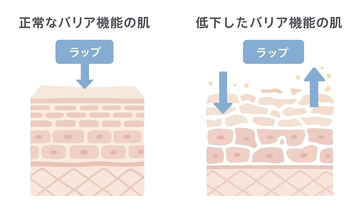 表皮バリア機能が弱るとどうなる!?|acco