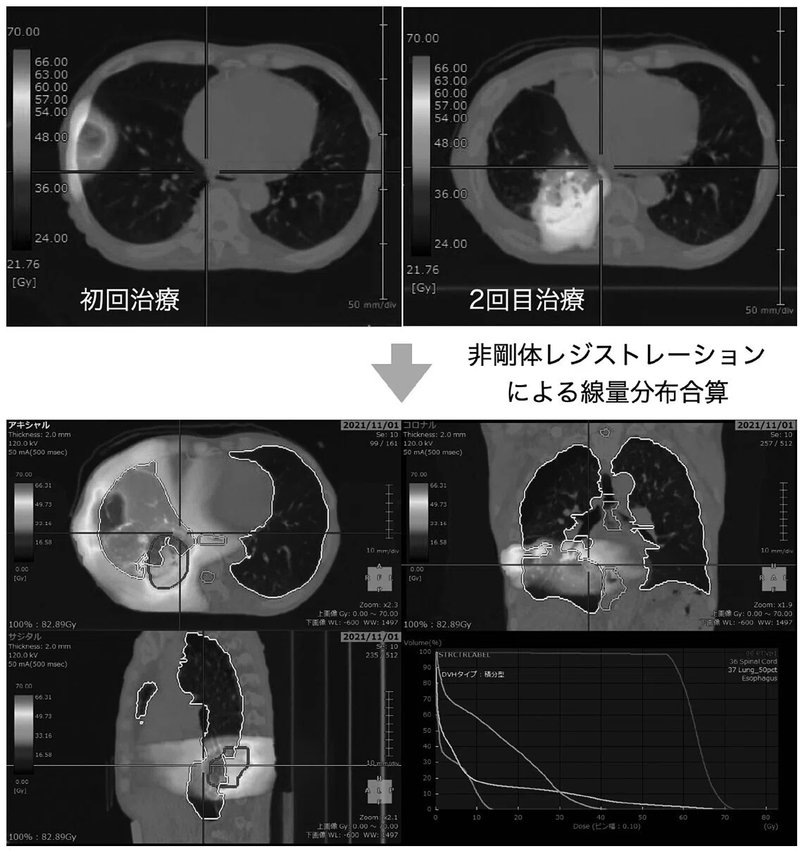 放射線治療計画支援装置「SYNAPSE Radiotherapy」がもたらす治療計画の