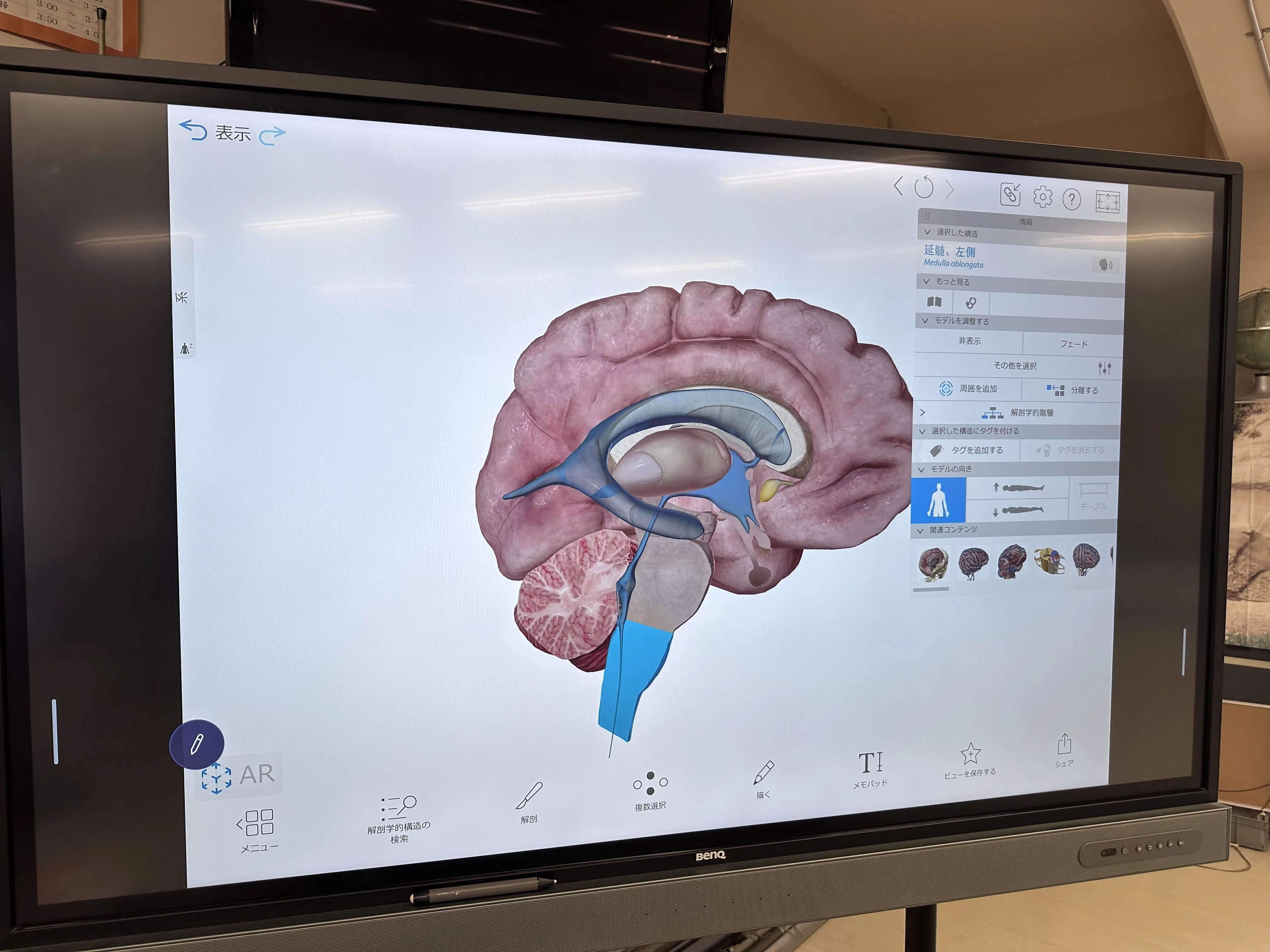 L デッドストック 蓄光 ヴィンテージ 脳 解剖 アナトミー anatomy 