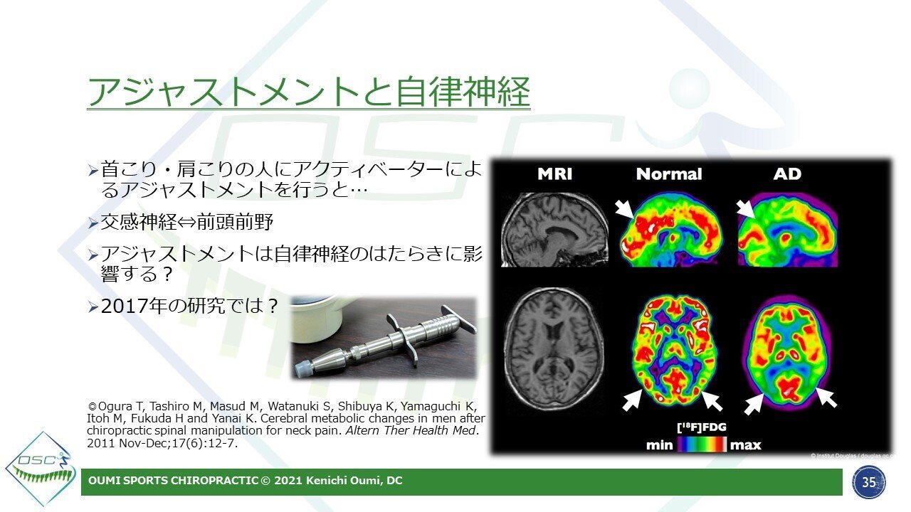 The Evidence Spine Project by OSC ～科学でみるカイロ
