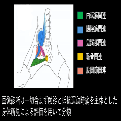 鼠径部痛に対する評価と治療 FAIS×Groin pain in athletes①｜Yuki