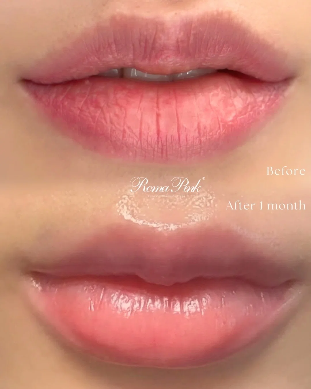 ローマピンク【東京銀座店、長野佐久店】Dearskin RomaPink Salon