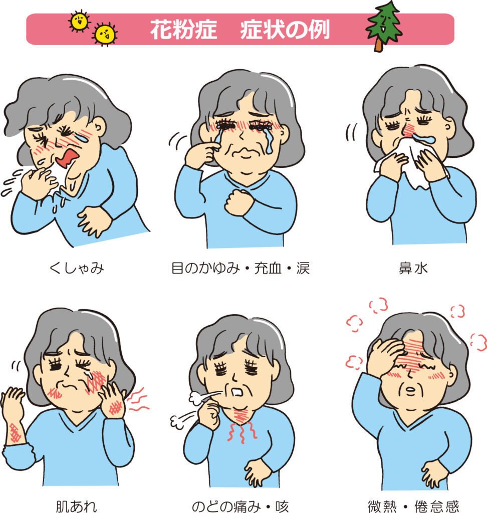 花粉症皮膚炎ってどんな病気？｜ヒフメド, image size:972x1024
