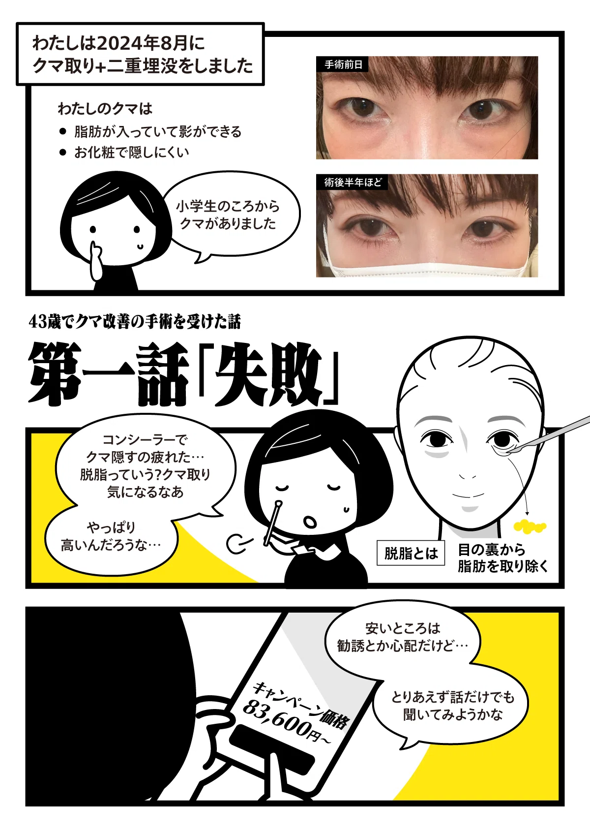 43歳で目の下のクマ改善の手術を受けた話【美容整形】｜spicagraph