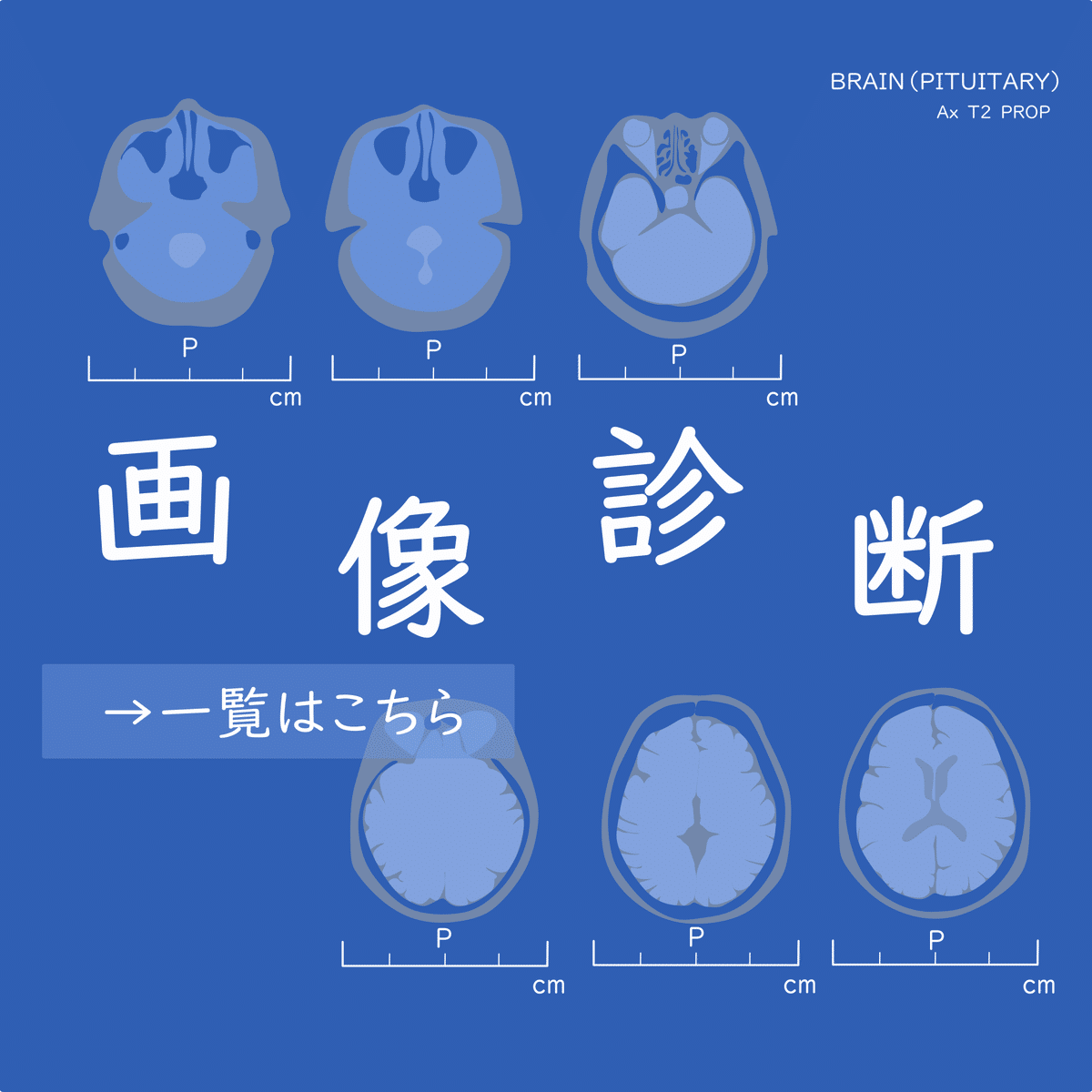 注目の10点をご紹介！『画像診断』特集 【2025年版】｜医書.jp/医学