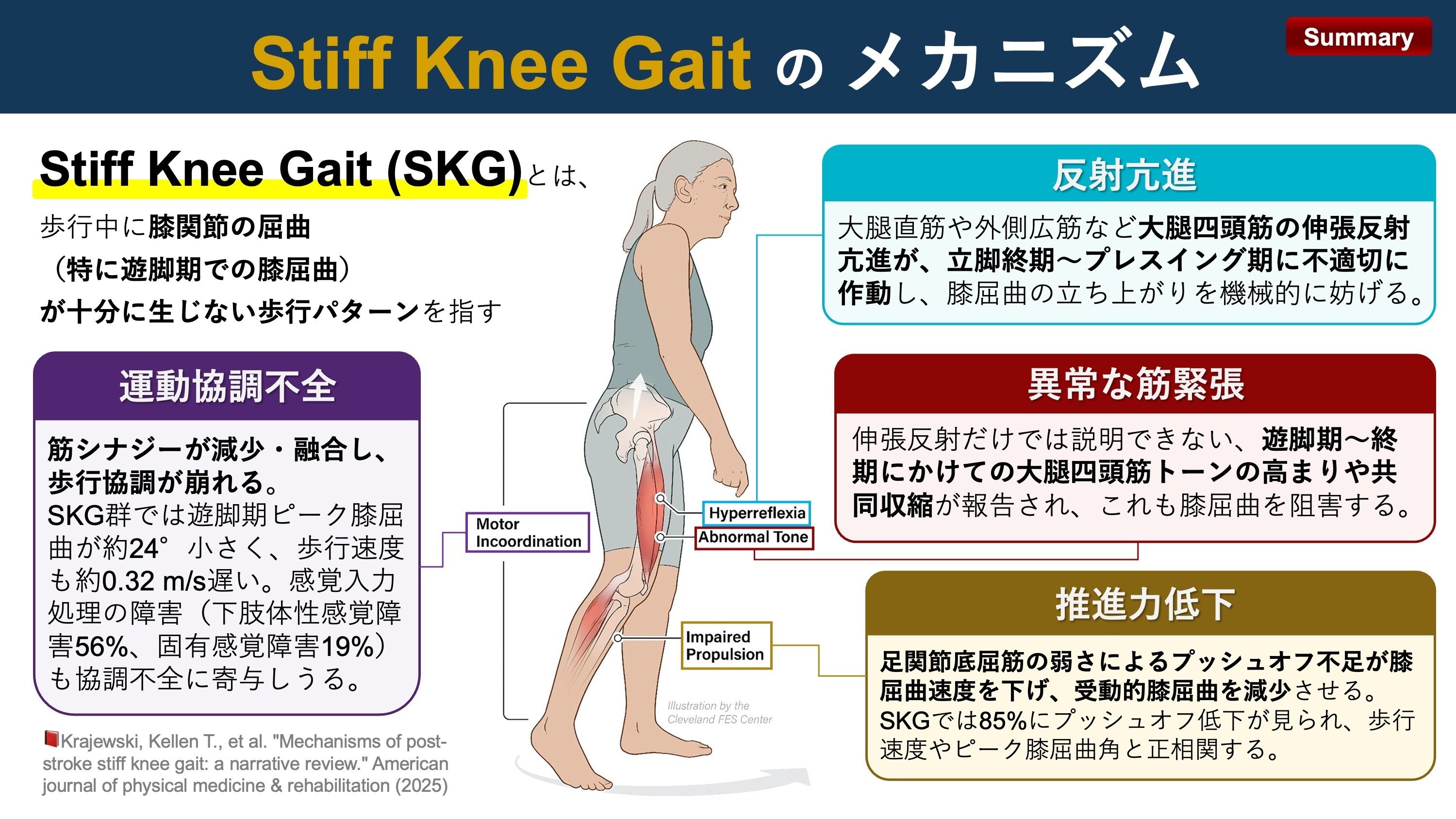 Stiff Knee Gaitのメカニズム｜Super Human | 理学療法士／保健