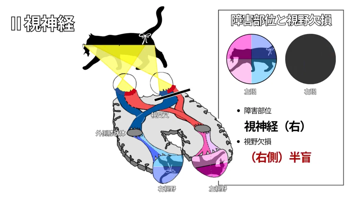 【国試頻出】視神経を徹底解説!機能と評価方法をわかりやすく整理|スキマ時間のリハビリ学
