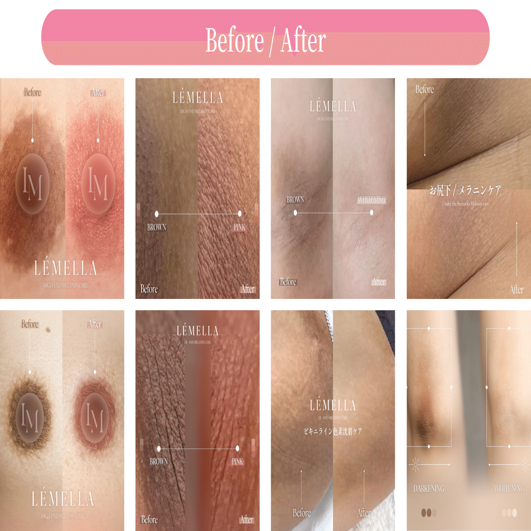 本音しか載せません。Lemellaを続けたお客様のリアルレビュー｜Letty