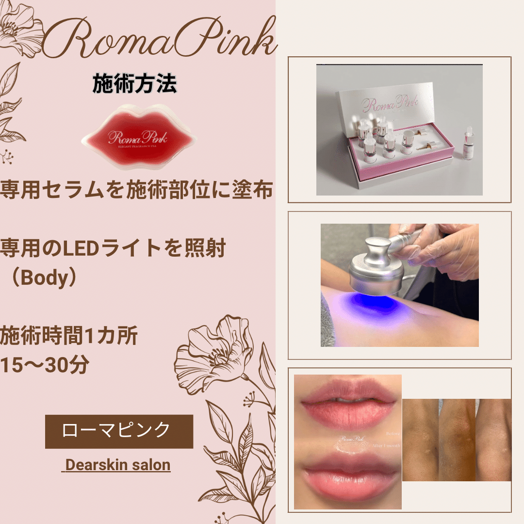 話題のローマピンク、施術方法は？ダウンタイムは？ （Dearskin