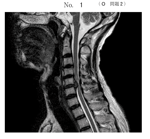 名作運動器リハ】関節のMRI 第2版 画像理学療法作業療法リハビリ