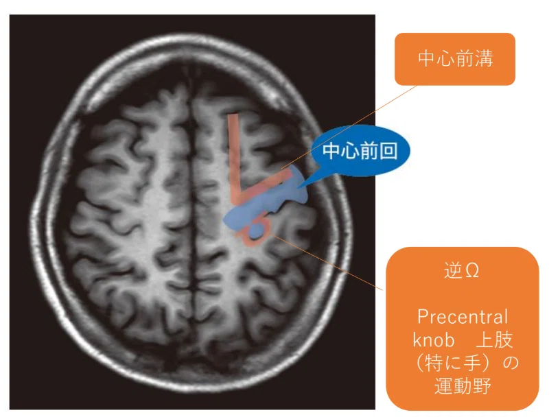 脳卒中画像から読み解く症状とリハビリ CT・MRI・FLAIR画像から損傷部位と症状の関係をやさしく解説｜taka@理学療法士