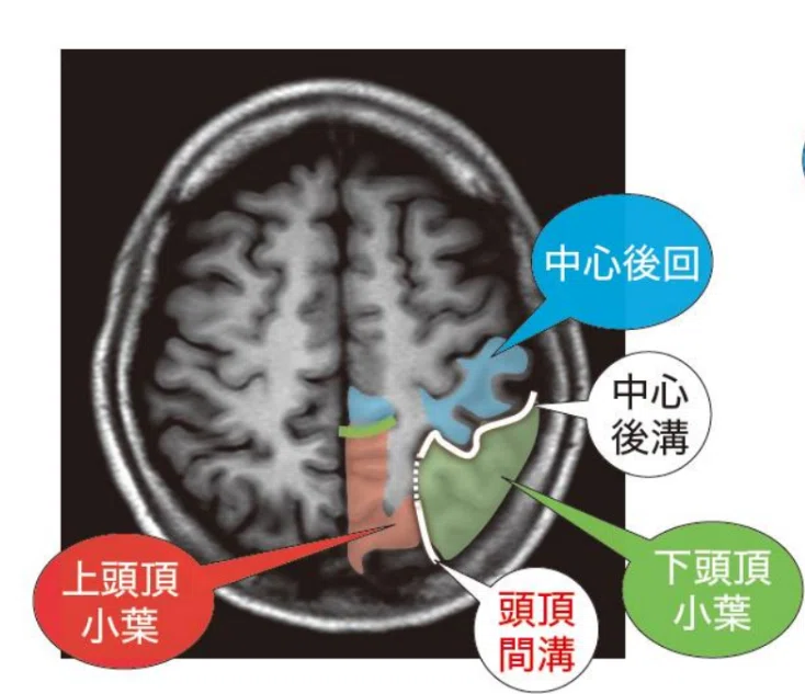 脳卒中画像から読み解く症状とリハビリ CT・MRI・FLAIR画像から損傷部位と症状の関係をやさしく解説｜taka@理学療法士