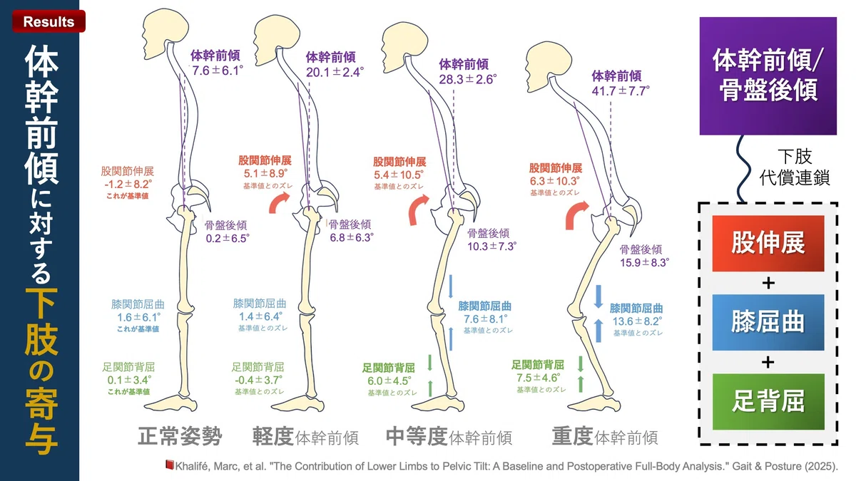 骨盤傾斜に対する下肢代償連鎖｜Super Human | 理学療法士／保健学博士 Ph.D.