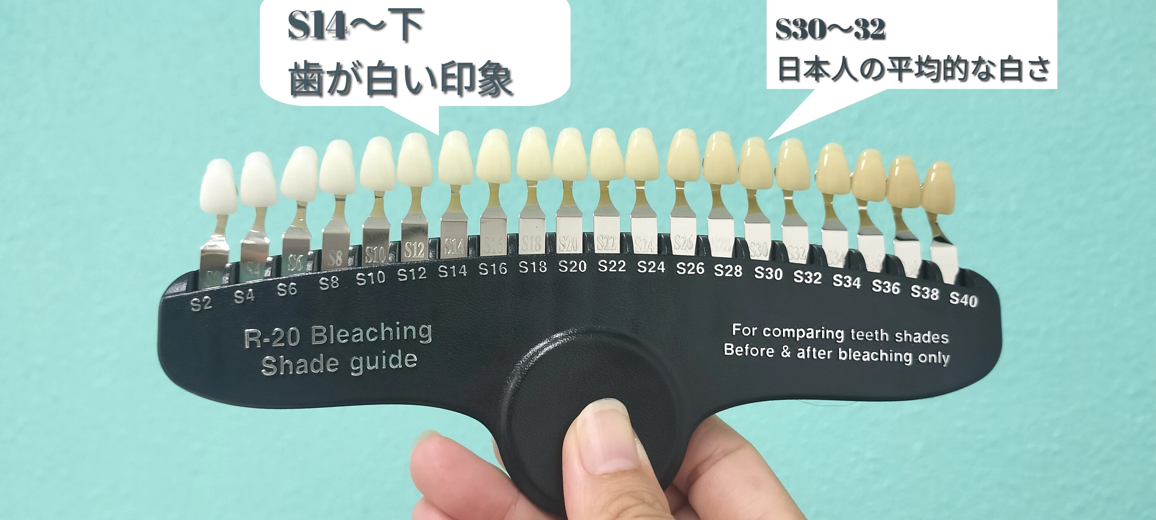 11月限定500円】S14の白さで印象UP♪沖縄市宮里で叶うナチュラル