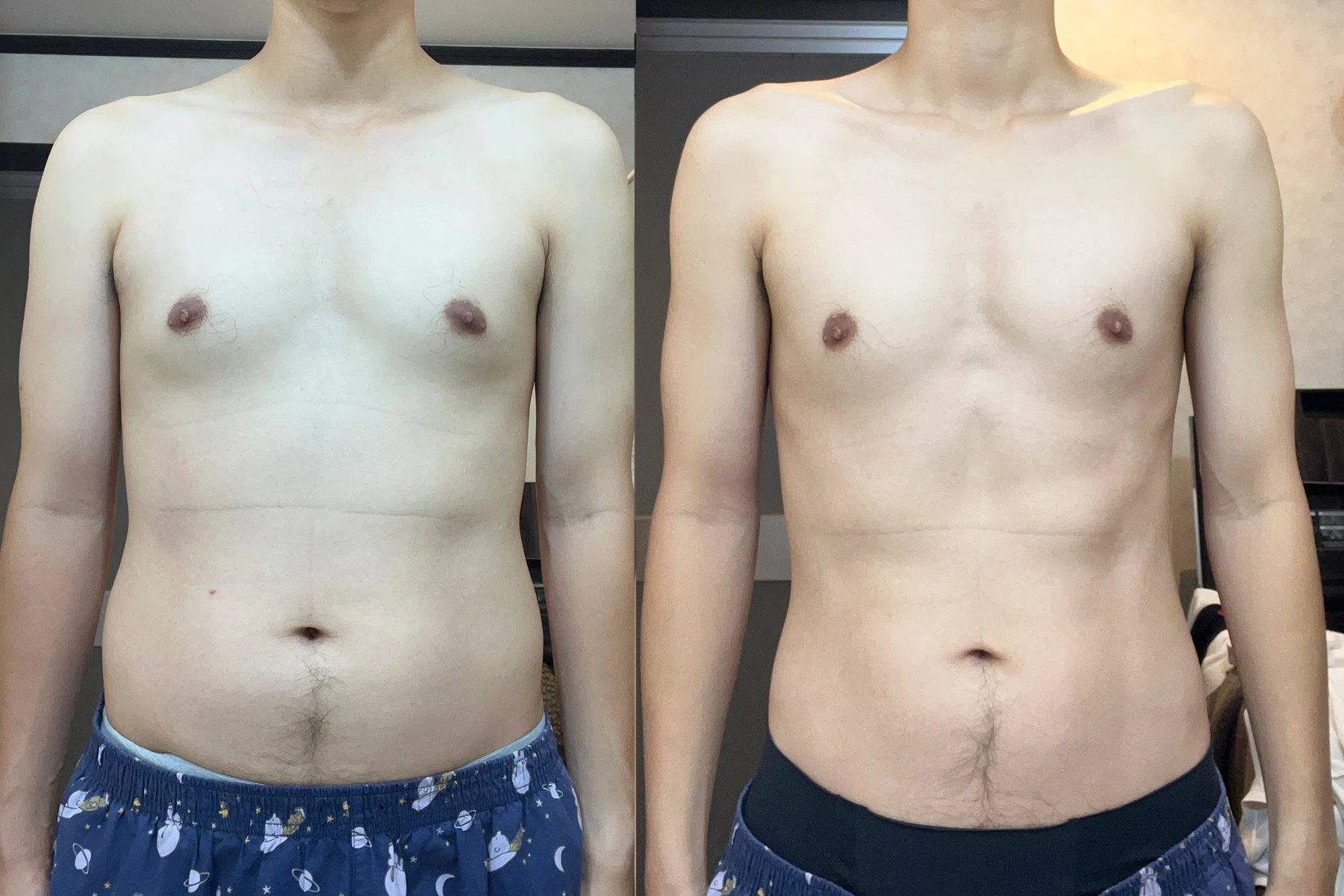 AIに従うだけで腹筋は割れるのか？11週目で見えてきた“成功の兆候”と