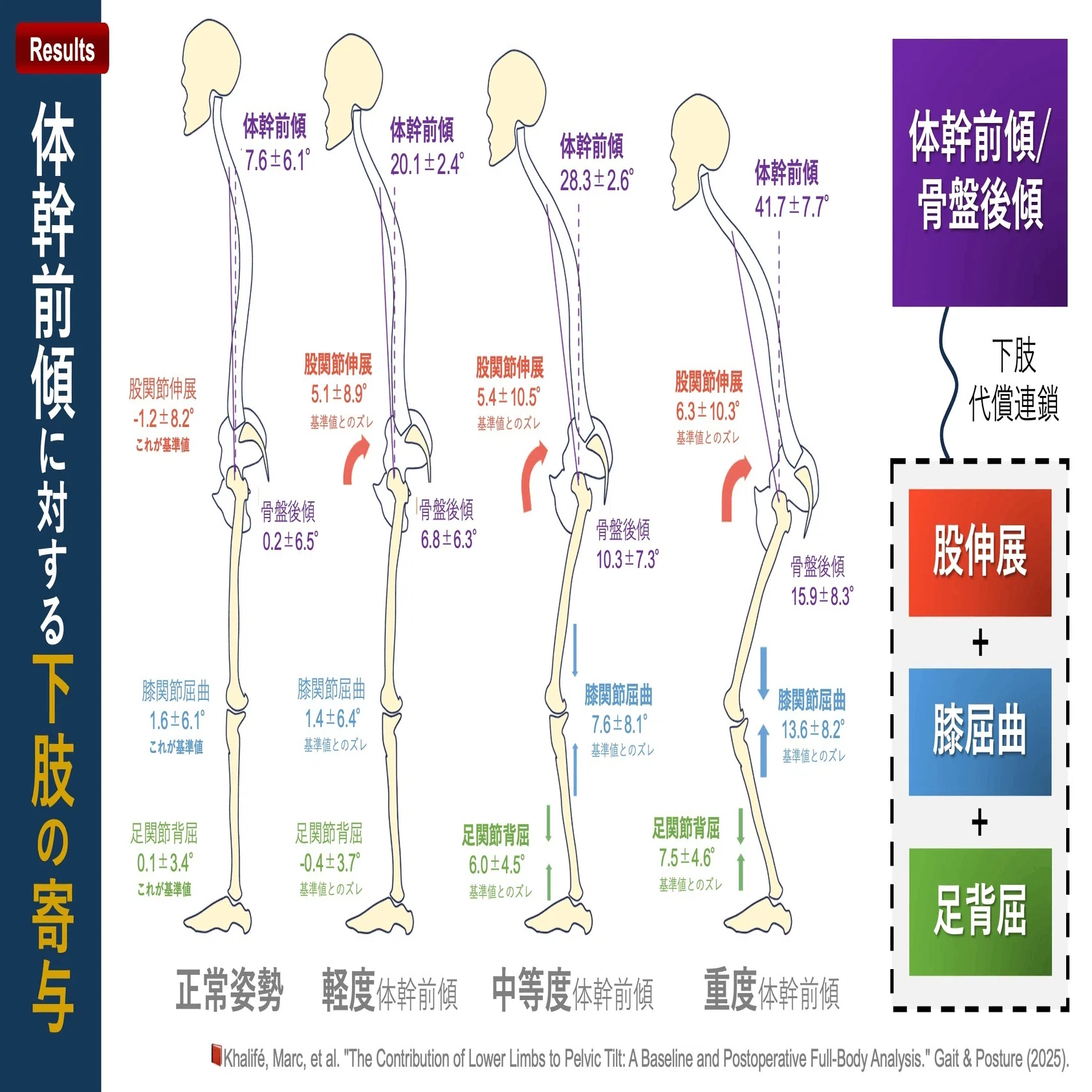 人工股関節置換術後の腰痛有病率｜Super Human | 理学療法士／保健学