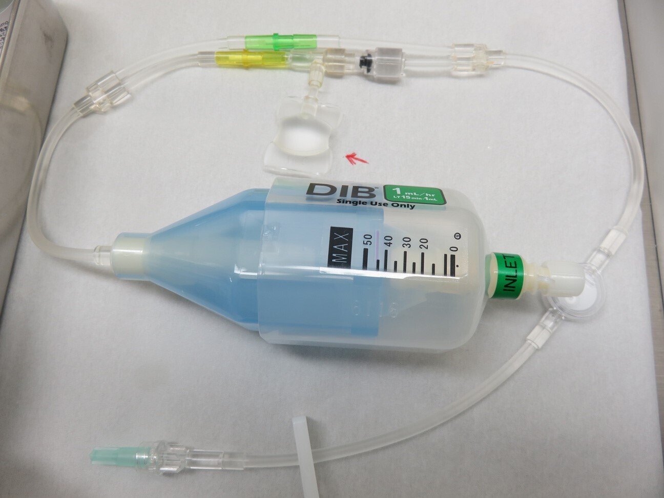 その4 骨盤の手術 - 痛すぎて眠れない夜｜だいとく