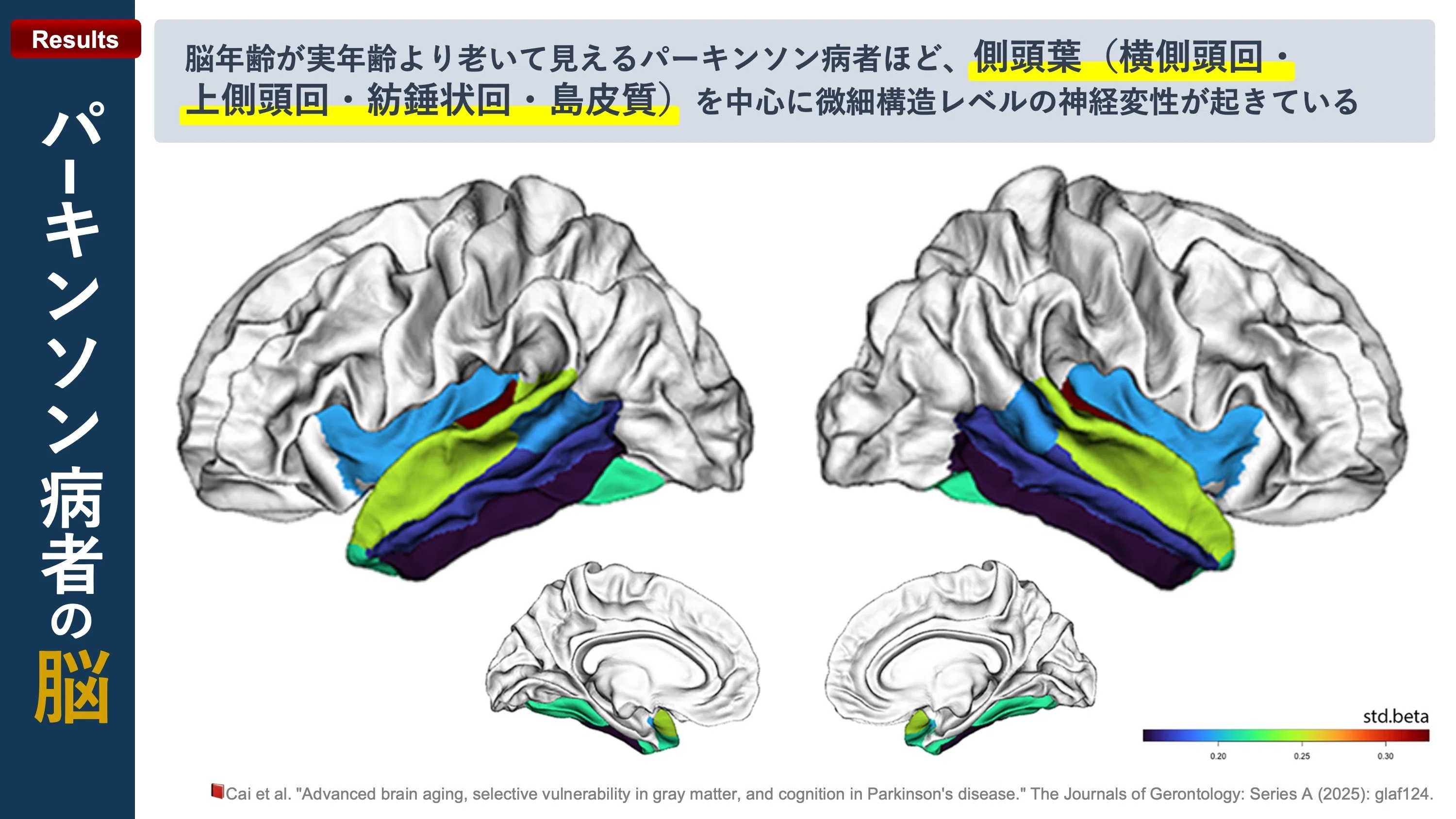 パーキンソン病者の脳｜Super Human | 理学療法士／保健学博士 Ph.D.