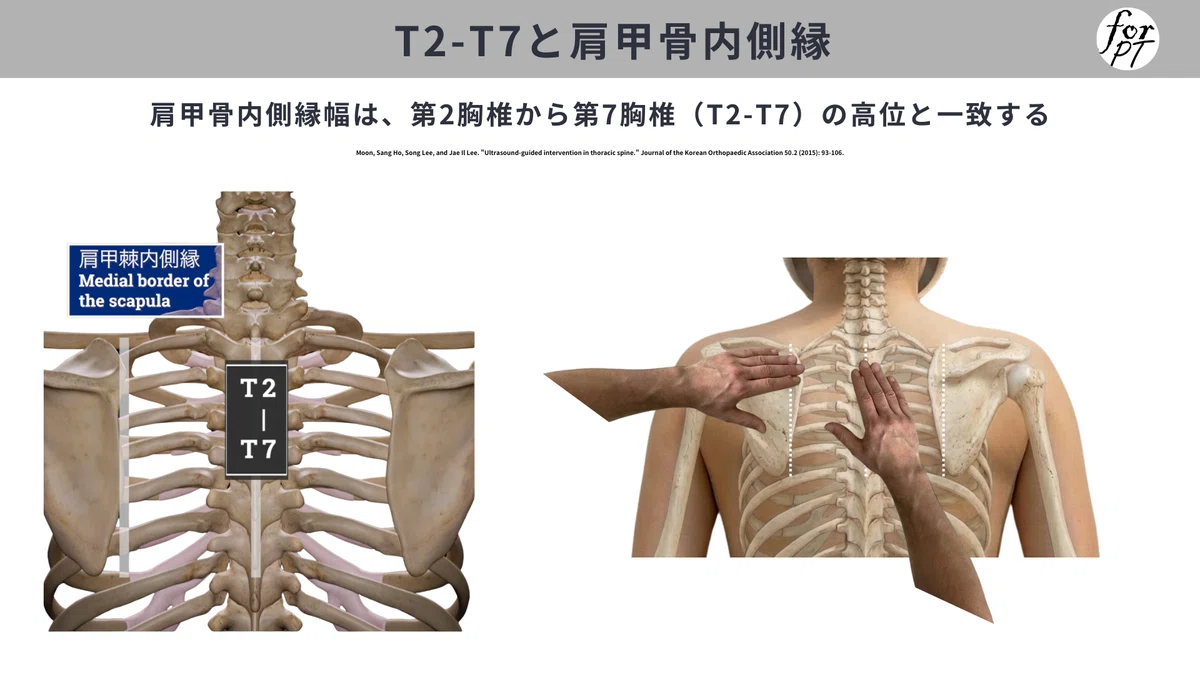 宗形テクニック 頸椎・胸椎部の痛みと肩こりの治療 Amazon.co.jp: 宗形テクニック Basic Part2～頚椎・胸椎部の痛みと