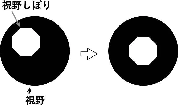 視野絞りと開口絞りについて|市川 壮彦