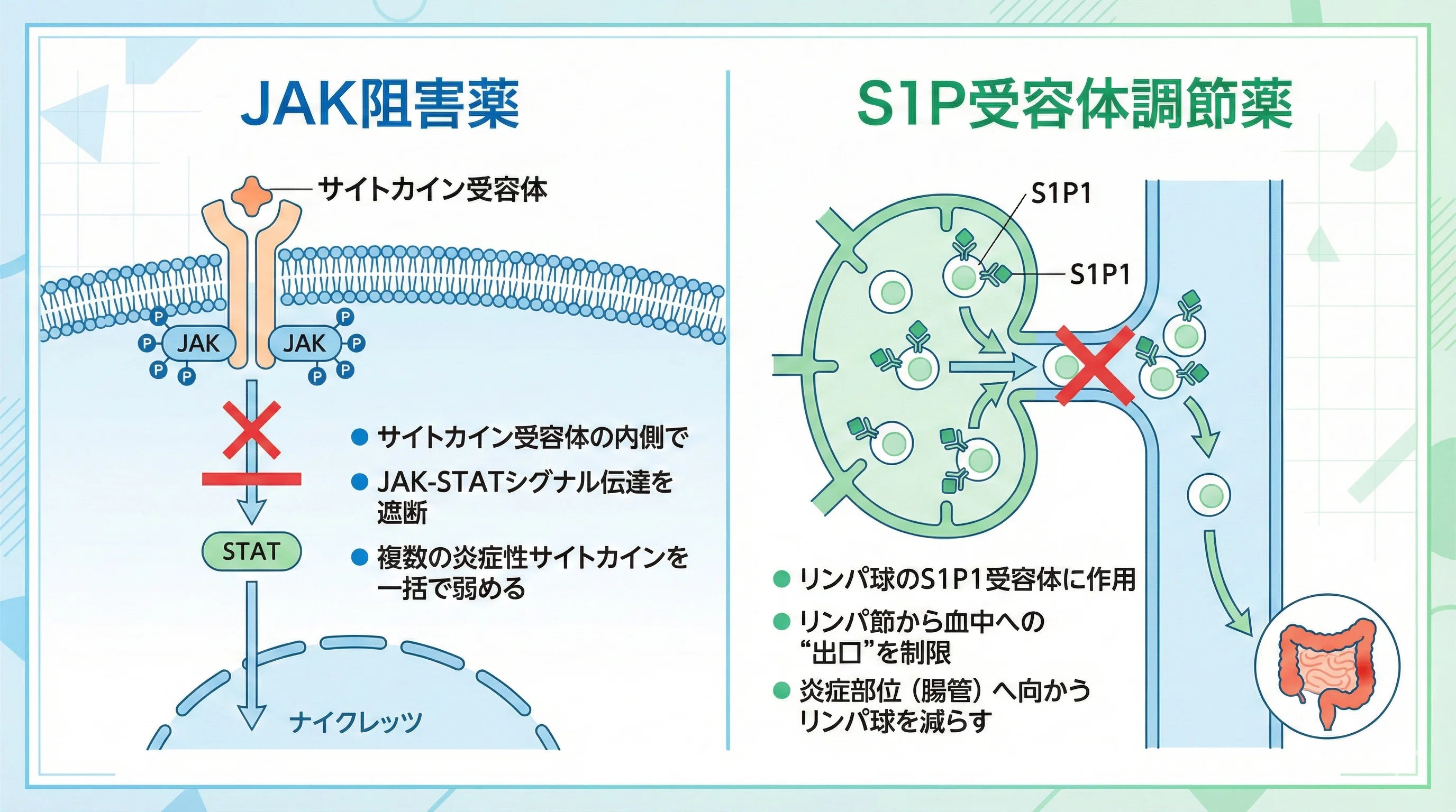 潰瘍性大腸炎治療「線路図」―― 薬局薬剤師のための実務 × エビデンス