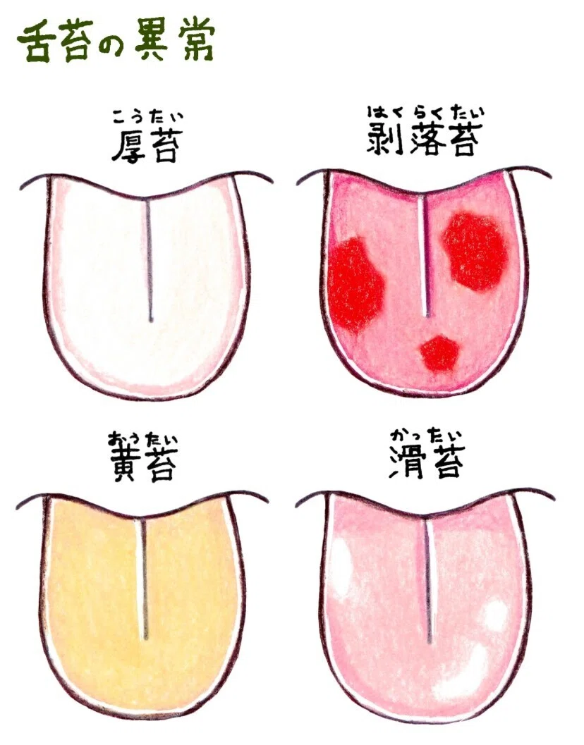 東洋医学の「舌診」 舌はからだの状態を映す鏡｜mimosa