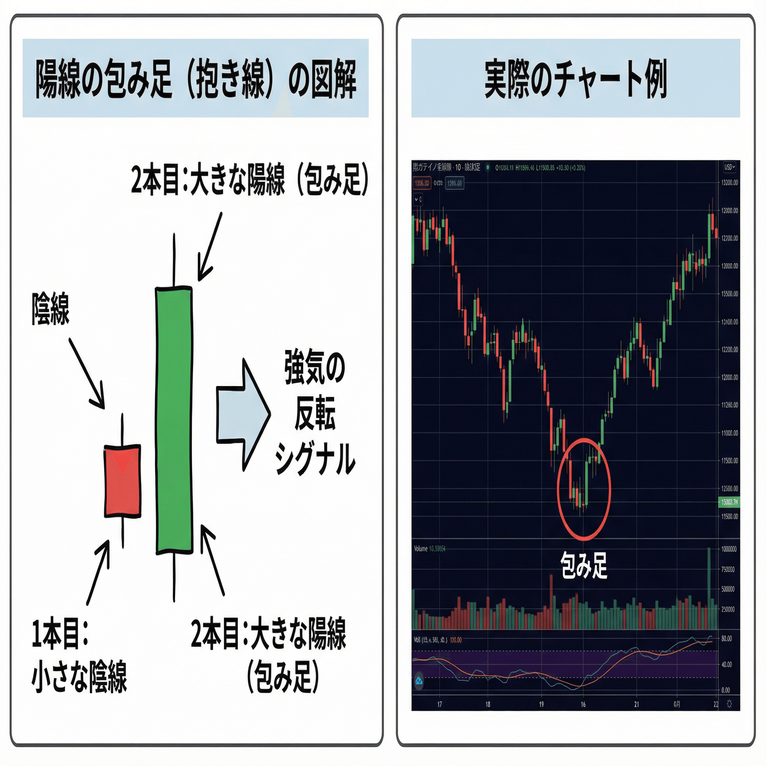 初心者向け】株で負けないための「チャート分析」超入門。私の失敗と成功の全てを公開します｜yuuun3830