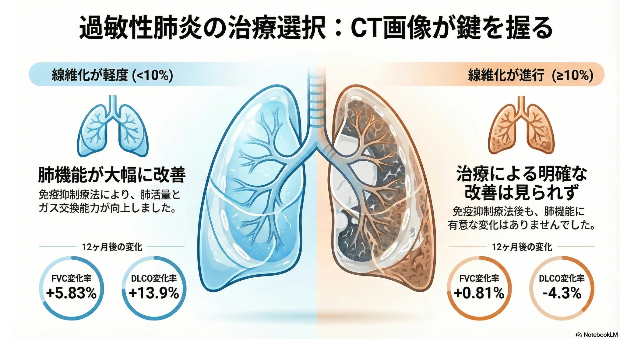 中医診断・治法 過敏性肺炎：画像所見が免疫抑制療法への反応を予測する『治療効果予測