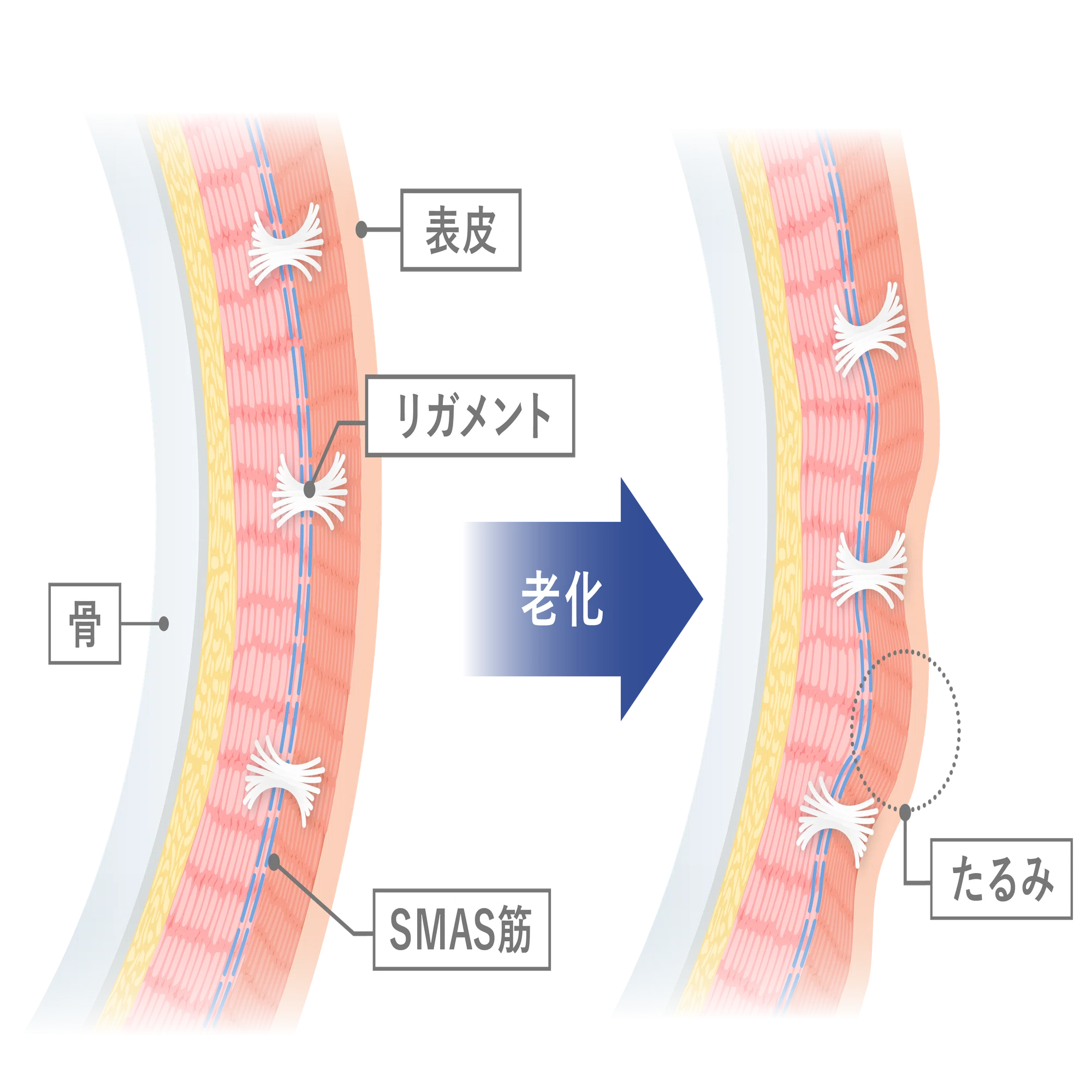 アラサー以降の外見改善において必須】アンチエイジング完全解説