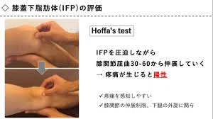 膝蓋下脂肪体（IFP）の病態生理と理学療法戦略の全容｜リハロジPT｜AI×哲学×リアル