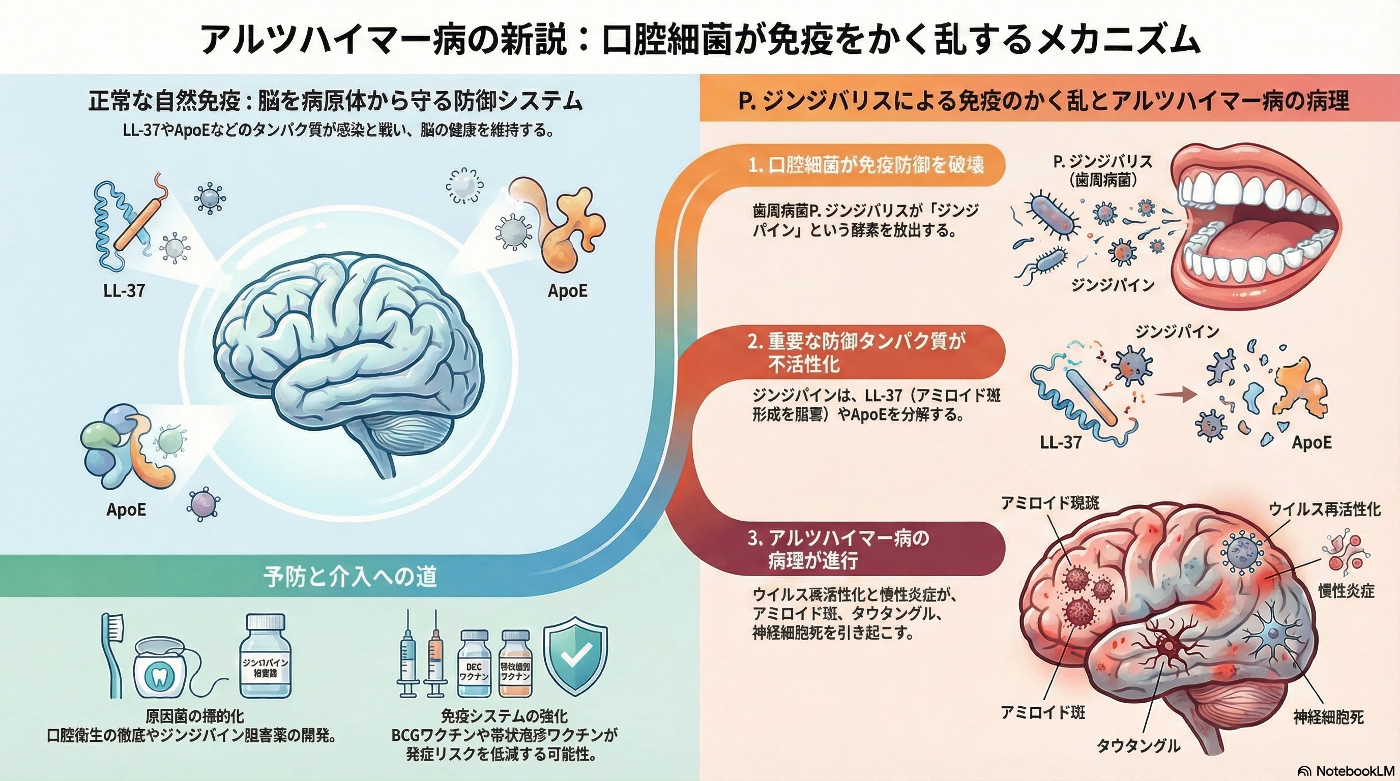 アルツハイマー型認知症：口腔内病原体であるポルフィロモナス