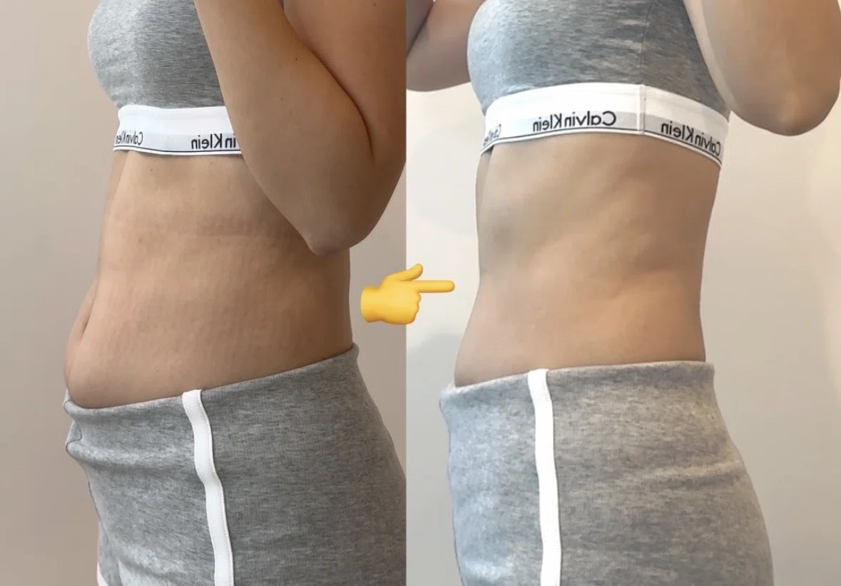 3日間で腸内環境整えて痩せる｜リアル実況報告🍑｜煎茶🕊️人生に共存