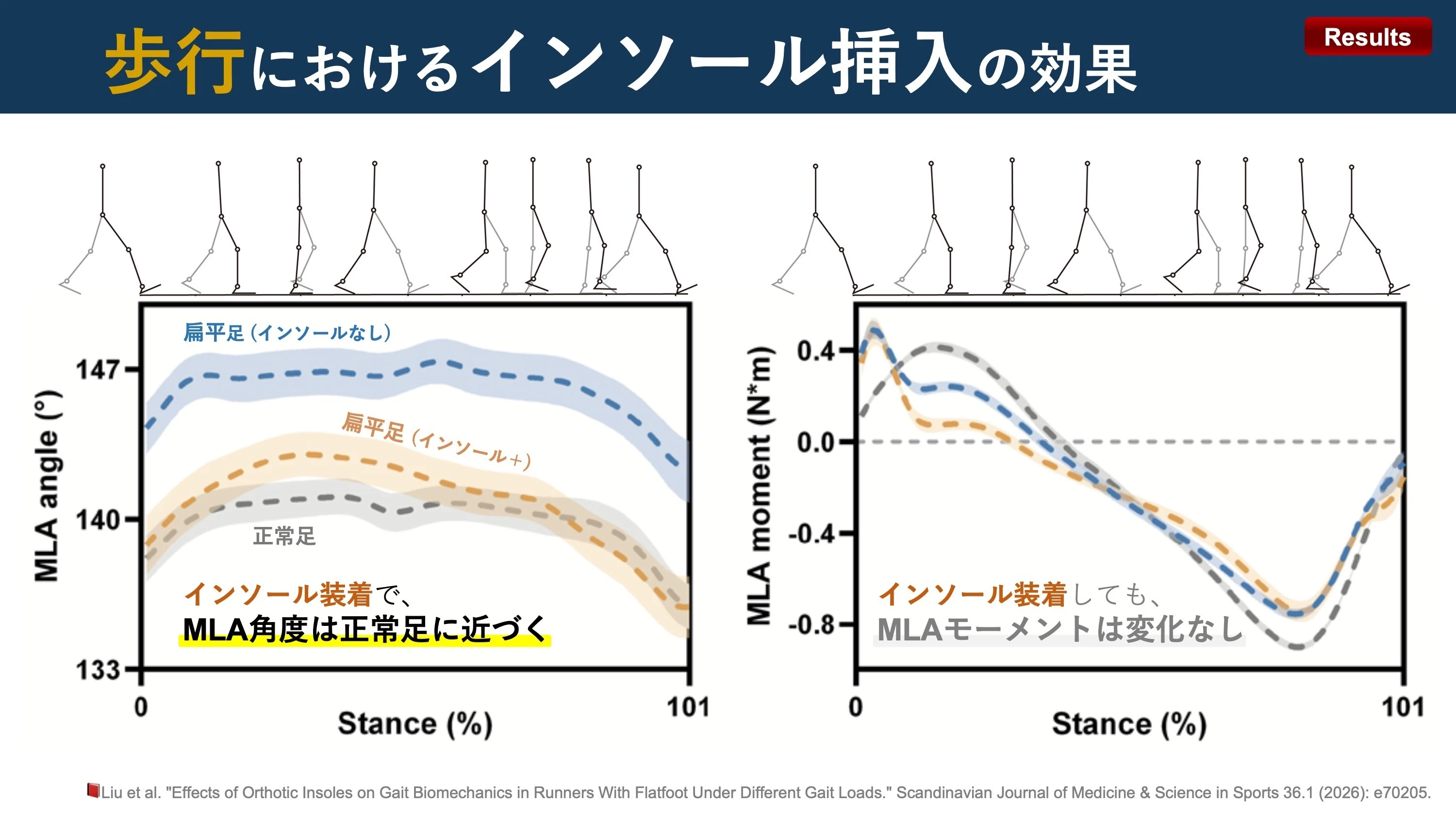 Orthotics Patterns Insoles change kinematics, but not kinetics|Super Human | 理学療法士/保健学博士 Ph.D.
