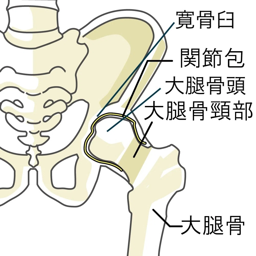 大腿骨寛骨臼インピンジメント【FAI】とは?変形性股関節症との関係や介入戦略も解説!|Kinetech公式