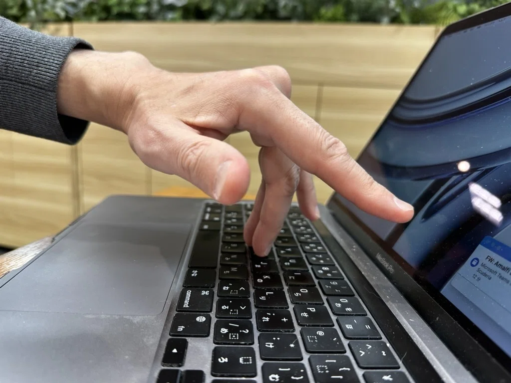 Middle Finger Muscles I was able to type on a keyboard for the first time in six months! — A ...