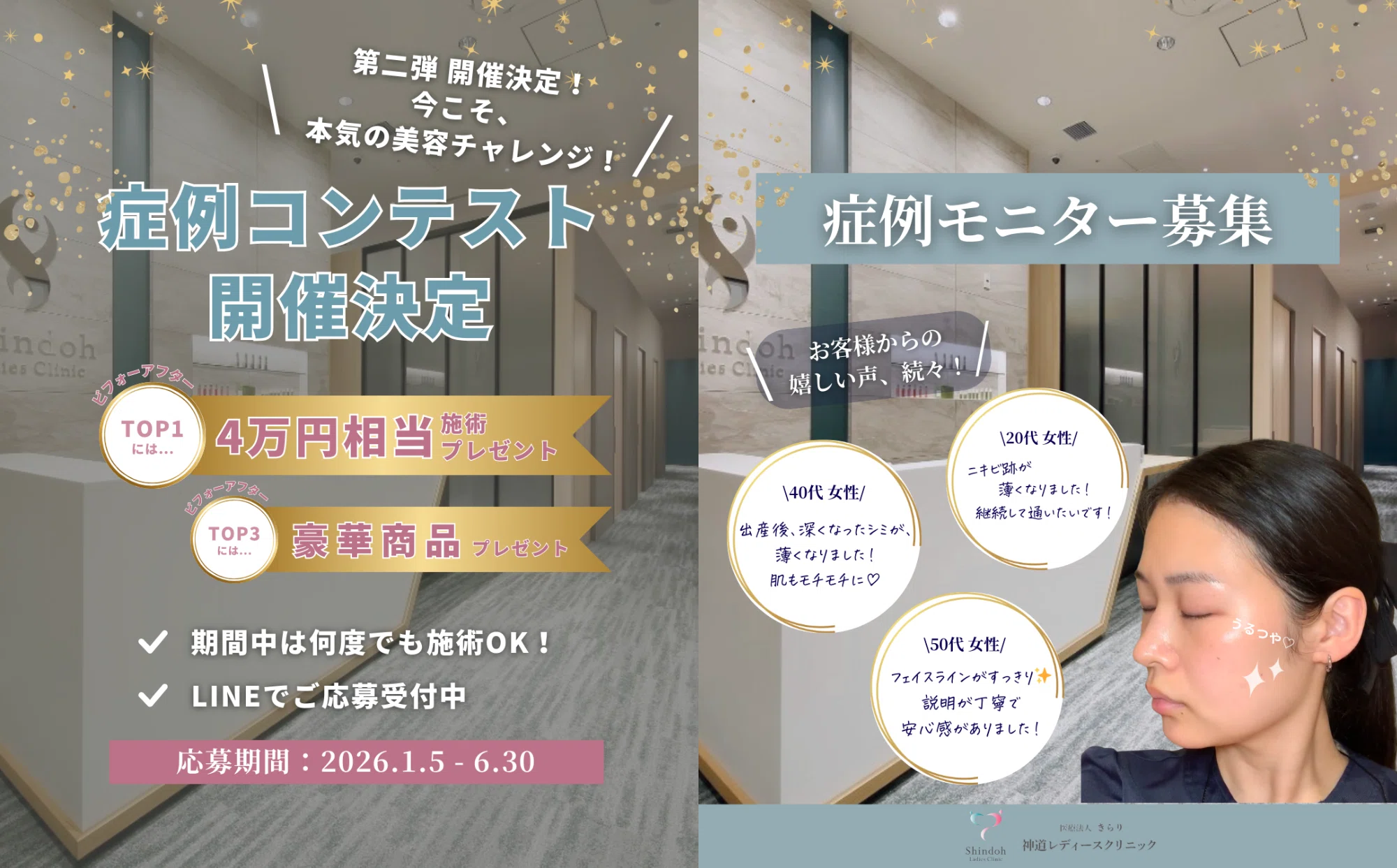 症例モニター募集】&【第二弾コンテスト】開催決定🎉 | 症例モニター募集】&【第二弾コンテスト】開催決定🎉 |