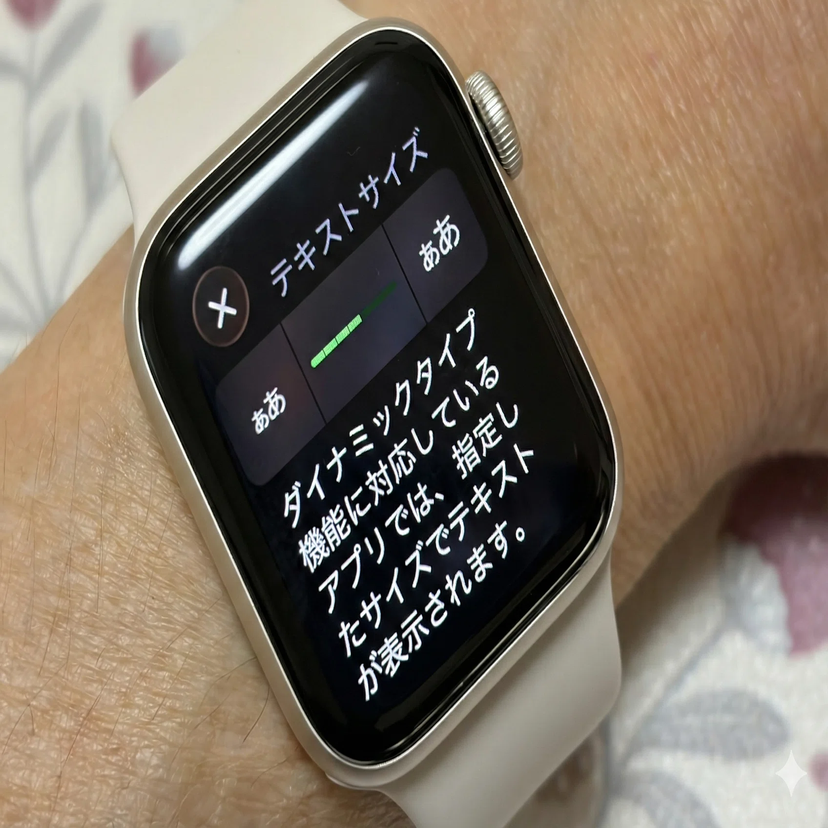 老眼でも快適！Apple Watchのサイズ選びと装着感のお話｜がじゅまる