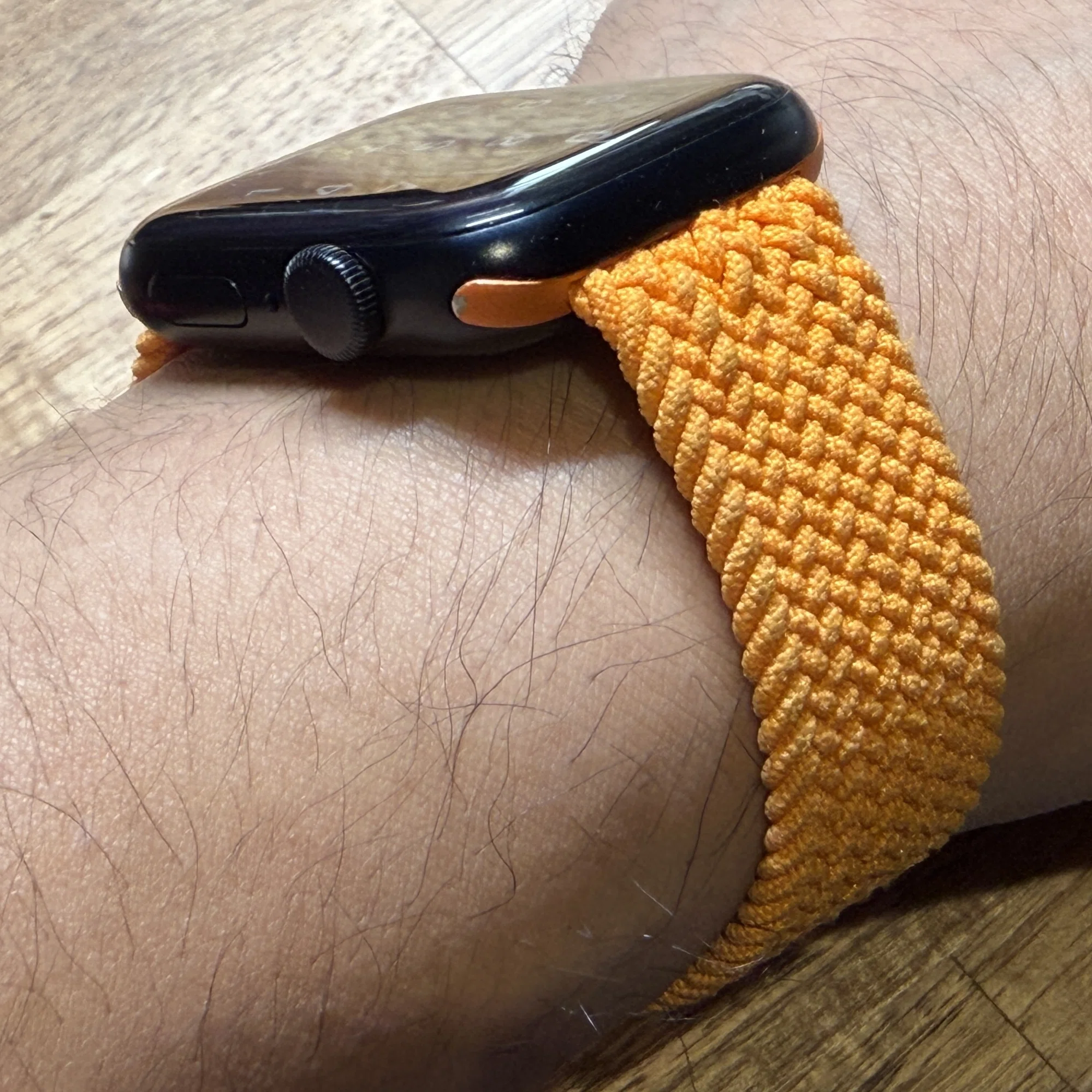 肌ヨワヨワ勢のApple Watchバンド選び｜サリチル酸