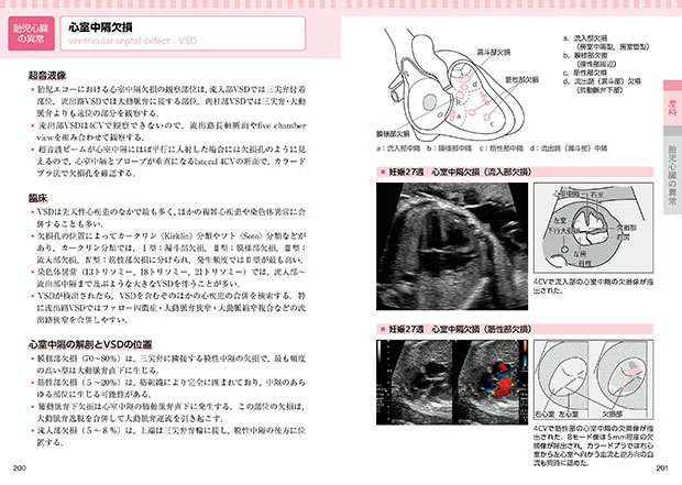 コンパクト超音波neo 産婦人科アトラス」〔新装改訂版〕2月下旬