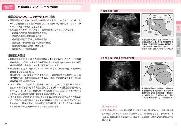 コンパクト超音波neo 産婦人科アトラス」〔新装改訂版〕2月下旬
